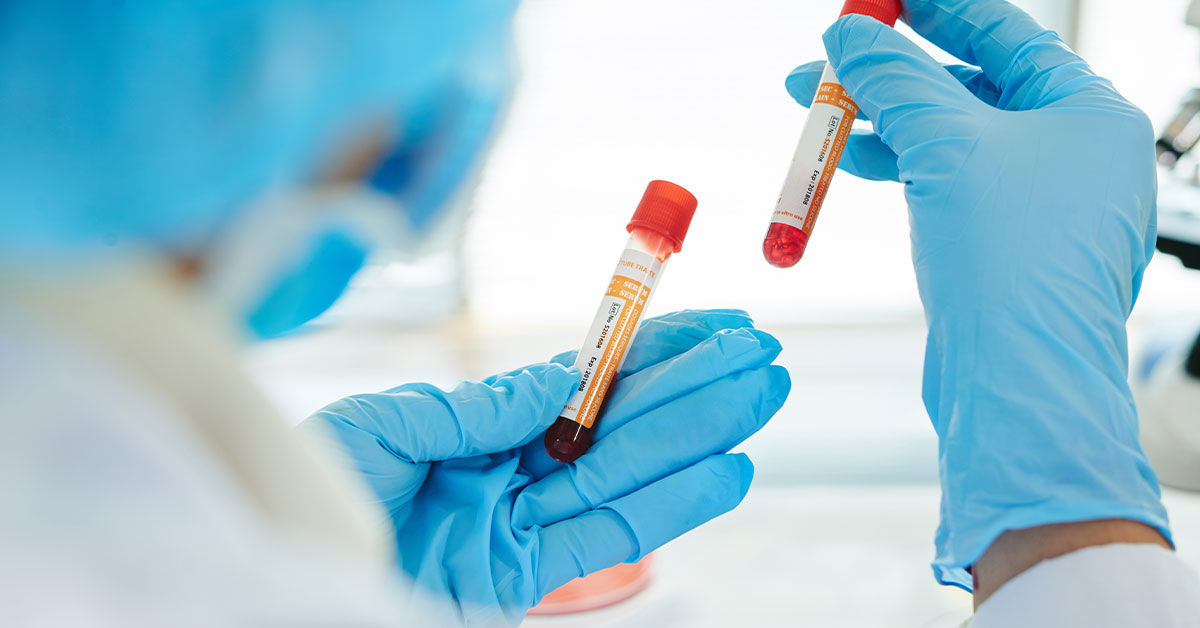 Complete Blood Count (CBC)